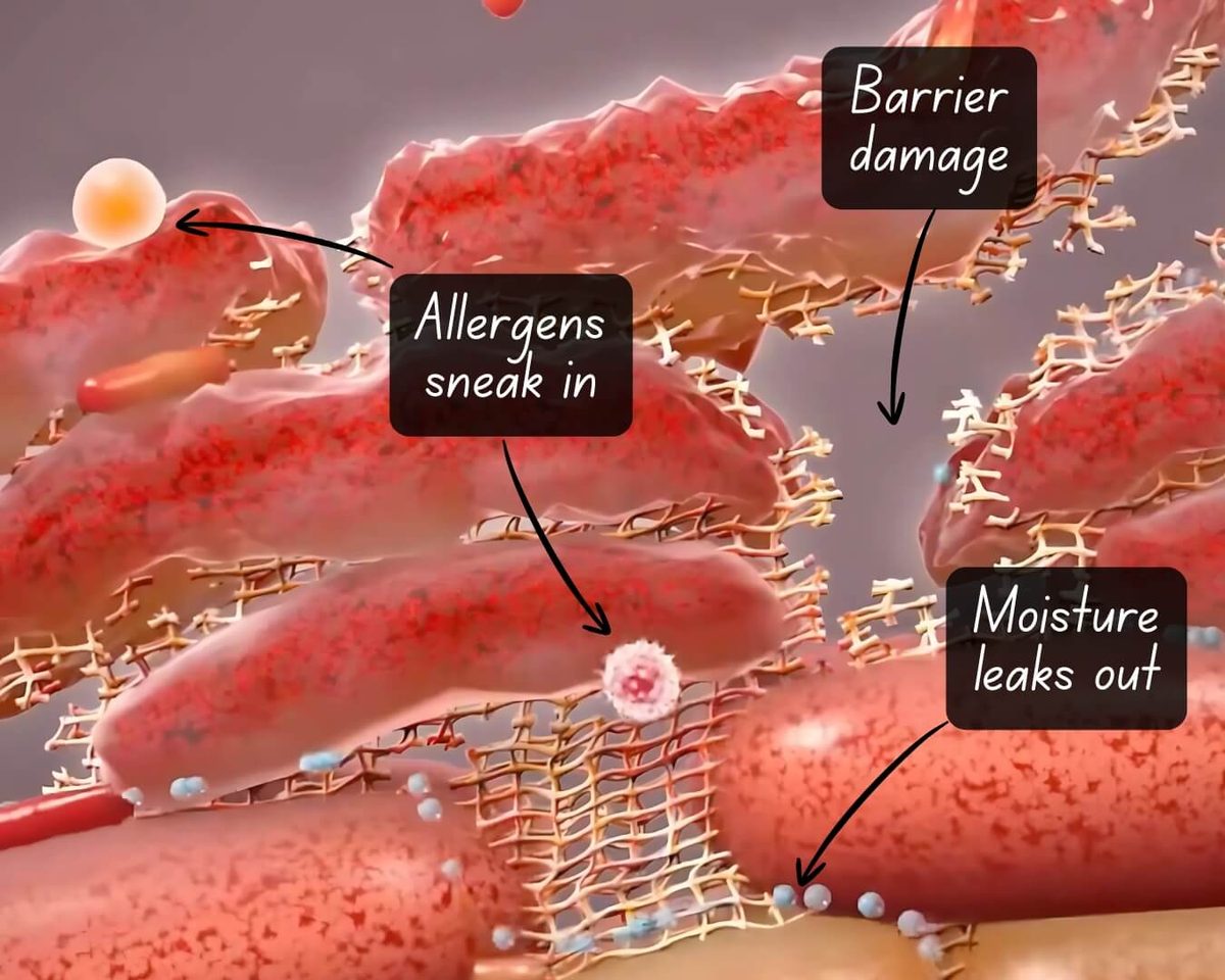 Barrier damage diagram